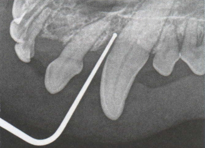 Rentenogram špičáku se zavedenou parodontální sondou