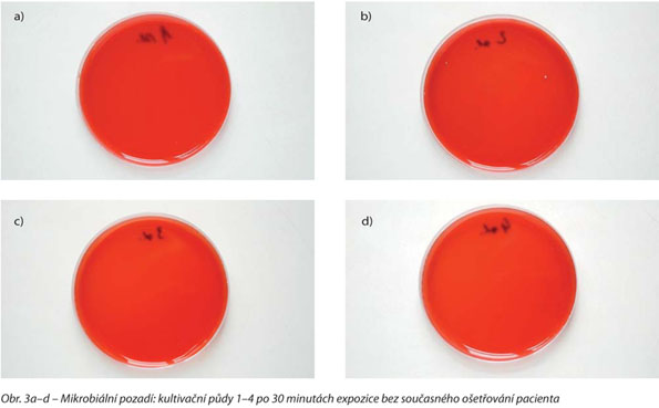 Mikrobiální pozadí: kultivační půdy 1–4 po 30 minutách expozice bez současného ošetřování pacienta