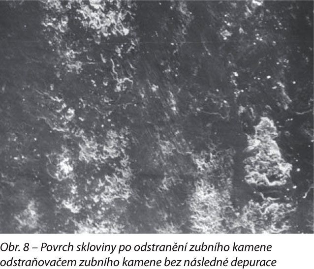 Povrch skloviny po odstranění zubního kamene odstraňovačem zubního kamene bez následné depurace