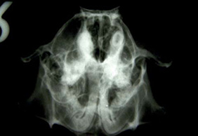 RC rentgenogram prezentovaného pacienta – patrná deformita a ztráta kresby pravého maxilárního řezáku v porovnání s levým