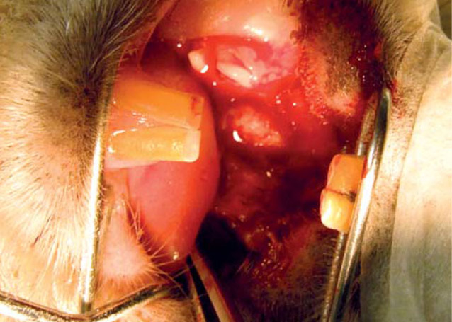 Operace – vizualizace perforujícho pseudoodontomu