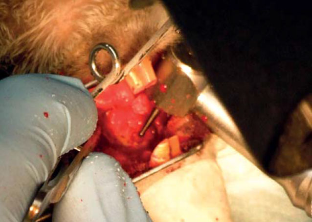Operace – odfrézovávání kostního podkladu patra