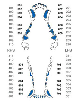 Schéma 1 – Modifikovaný Triadanův systém. Dočasná dentice je zvýrazněna modře (upraveno podle Canine Dental Tooth Chart, www.AnasaziVet.com)
