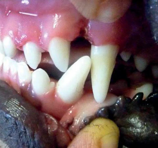 Stav po sejmutí nákusné desky 6 týdnů po zahájení ortodontického ošetření