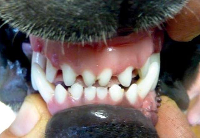 Frontální pohled po ortodontickém ošetření – špičák zřetelně vykloněn labiálně /netraumatizuje tvrdé patro/