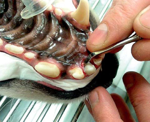 Odstranění cementu z okolí zubu