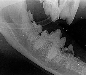Resorptivní léze v oblasti zubních korunek i kořenů