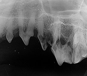 Resorptivní léze v oblasti zubních korunek i kořenů