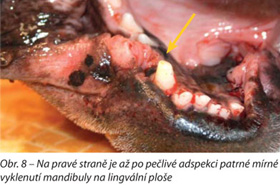 Na pravé straně je až po pečlivé adspekci patrné mírné vyklenutí mandibuly na lingvální ploše