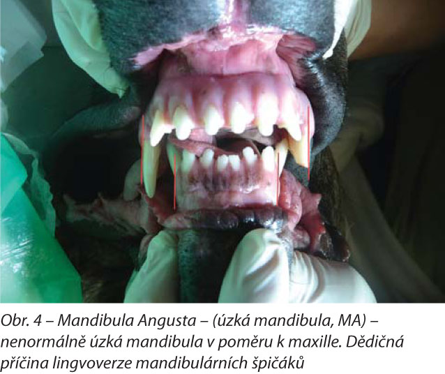 Mandibula Angusta – (úzká mandibula, MA) – nenormálně úzká mandibula v poměru k maxille. Dědičná příčina lingvoverze mandibulárních špičáků